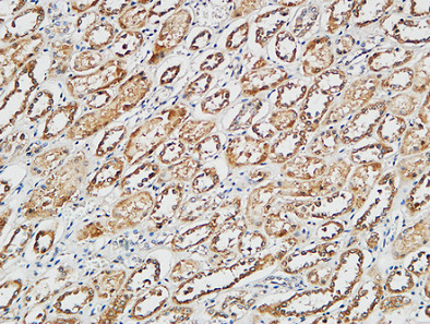 IHC - p38 Polyclonal Antibody AP71696